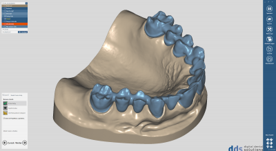 dds dentalCAD, core lab version, flexible Lizenz