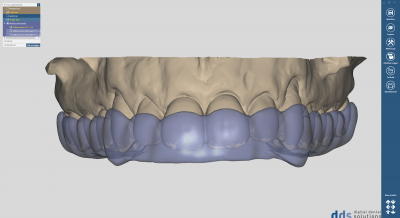 dds chairsideCAD bite splint module