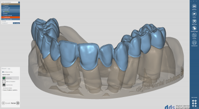 dds dentalCAD model creator module