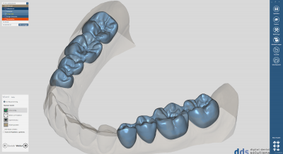 dds dentalCAD, advanced lab bundle, flexible Lizenz