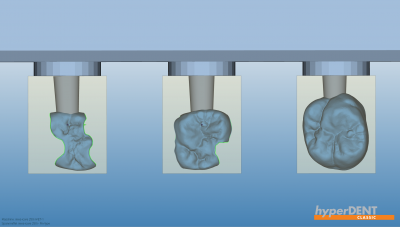 hyperDENT® grinding module