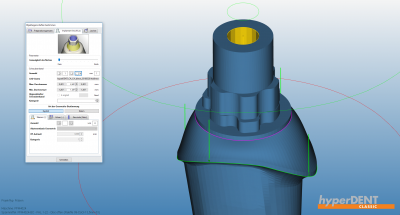 hyperDENT® interface geometry