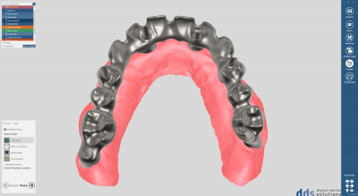 dds dentalCAD implant module