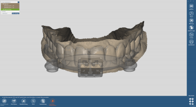 dds dentalCAD jaw motion import module