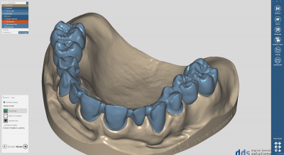 dds dentalCAD core lab version, permanente Lizenz mit Upgrade-Vertrag