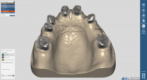 dds dentalCAD true smile module