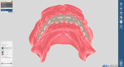 dds dentalCAD full denture module