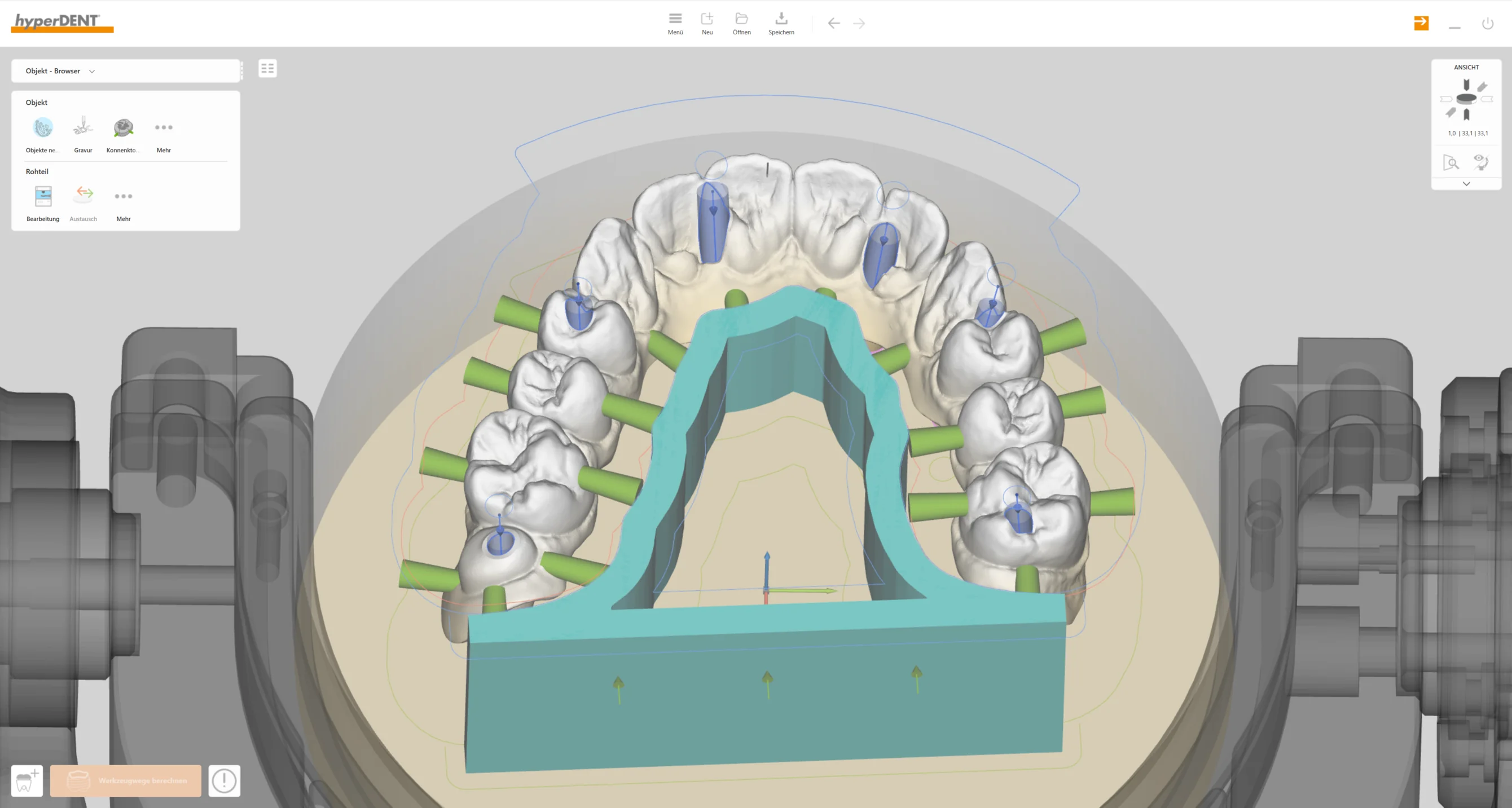 hyperDENT® CAM-Software