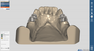 dds dentalCAD true smile module