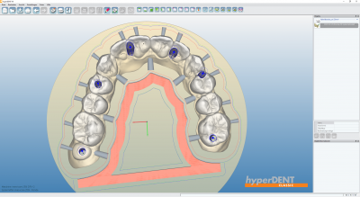 hyperDENT® Classic 5x simultan