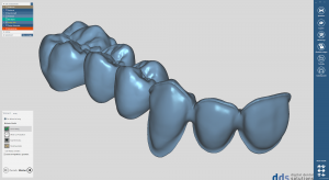 dds dentalCAD Demo Lizenz
