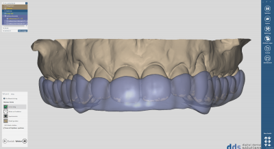 dds dentalCAD bite splint module