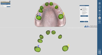 dds dentalCAD taktil core lab version, permanente Lizenz mit Upgrade-Vertrag