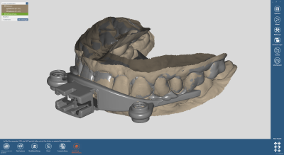 dds dentalCAD jaw motion import module