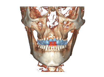 dds dentalCAD DICOM viewer module