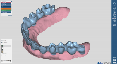 dds dentalCAD, implant lab bundle, flexible Lizenz