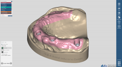 dds dentalCAD model creator module