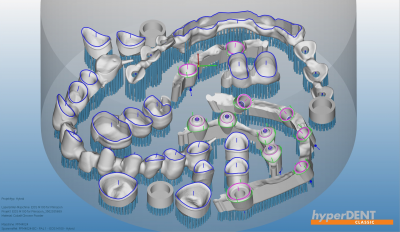 hyperDENT® hybrid module