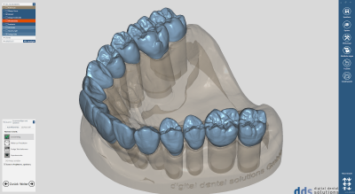 dds dentalCAD ultimate lab bundle, permanente Lizenz mit Upgrade-Vertrag