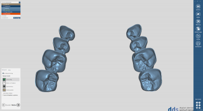 dds dentalCAD provisional module