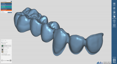 dds dentalCAD Demo Lizenz