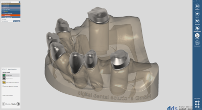 dds dentalCAD, ultimate lab bundle, flexible Lizenz