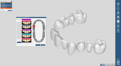 tooth library ZRS Wiedmann