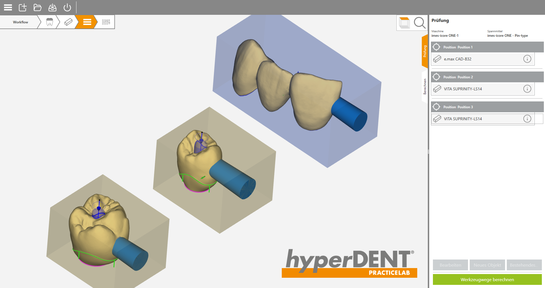 hyperDENT® PracticeLab 5x CAMSOFTWARE SOFTWARE digital dental