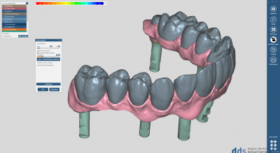 dds dentalCAD implant lab bundle, permanente Lizenz mit Upgrade-Vertrag