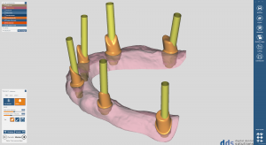 dds dentalCAD implant lab bundle, permanente Lizenz