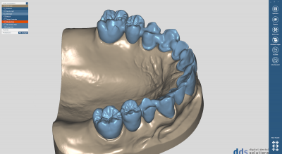 dds chairsideCAD permanente Lizenz mit Upgrade-Vertrag