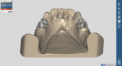 dds chairsideCAD true smile module
