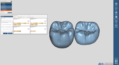 dds dentalCAD inCAD nesting module