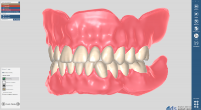 dds dentalCAD full denture module