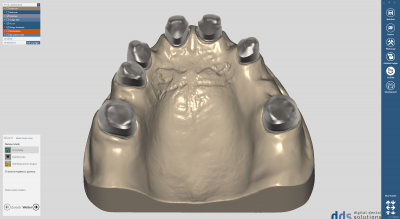 dds dentalCAD true smile module